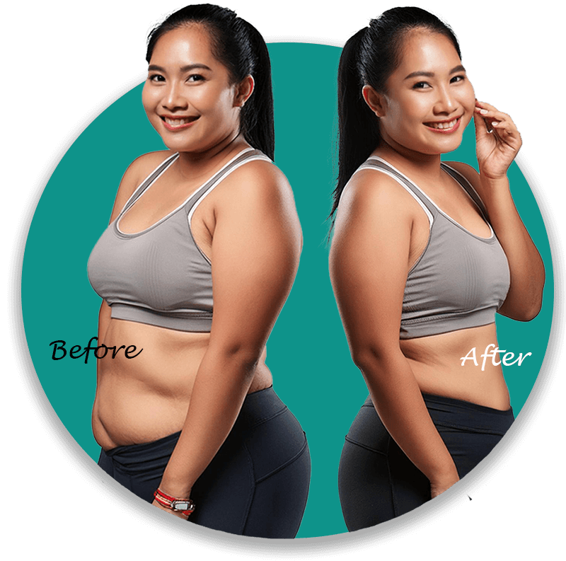 before-after